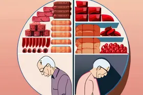 餐后血糖飙升与阿尔茨海默病风险相关