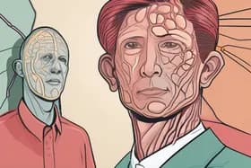 Nature Flags Concern Over Key Lymph Node Disease Study