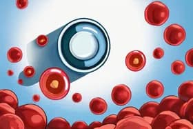 2型糖尿病:血管損傷における赤血球の役割が明らかに
