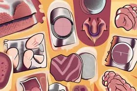 酮疹:神秘瘙痒或能揭示克罗恩病线索