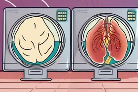 Risque de démence lié à l'obésité et à la ménopause ; l'éruption cutanée de type « keto » révèle des problèmes intestinaux